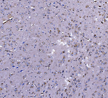 Anti-EEF2/Elongation factor 2 Antibody