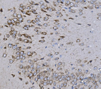 Anti-KCNQ5 Antibody