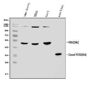 Presenilin 2/AD5/PSEN2 Antibody