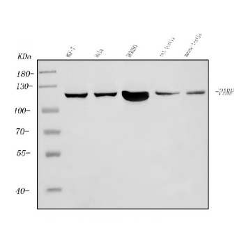 PARP/PARP1 Antibody (monoclonal, 2I2H4)