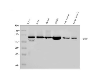 PARP/PARP1 Antibody (monoclonal, 10E11)