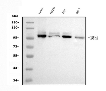 UBE3A Antibody (monoclonal, 8I3)