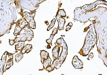 Anti-ADAMTS5 Antibody