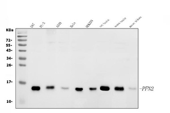 Profilin 2/PFN2 Antibody