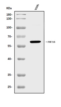 PHF21B Antibody