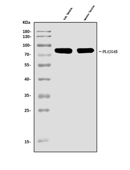 cPLA2 beta/PLA2G4B Antibody