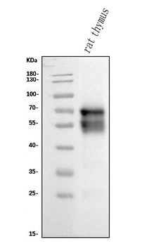 CD5 Antibody (monoclonal, 11B4)