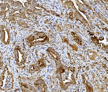 Anti-PDIA5 Antibody