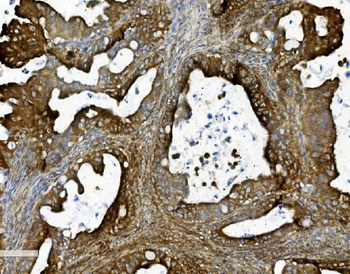 Anti-Prohibitin/PHB Antibody