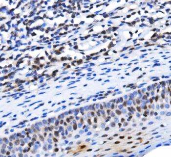 Anti-TAF4 Antibody