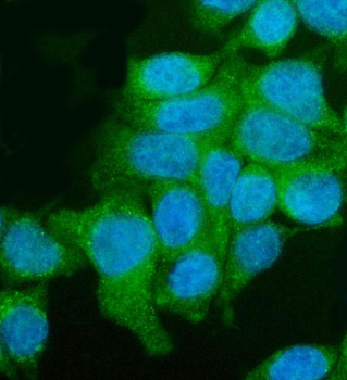Anti-Utrophin/UTRN Antibody
