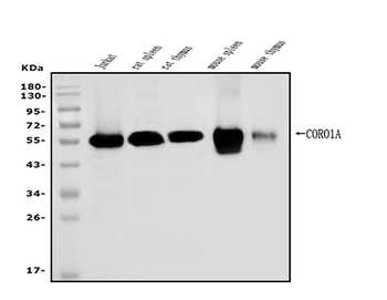 Coronin 1a/TACO/CORO1A Antibody