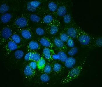 Anti-Integrin linked ILK Antibody