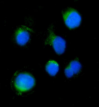 Anti-SERINC3 Antibody