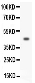 Homeobox protein Hox-A3 HOXA3 Antibody