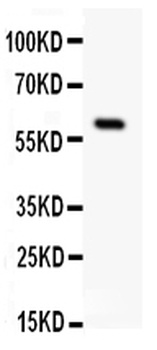 Somatostatin Receptor 1/SSTR1 Antibody