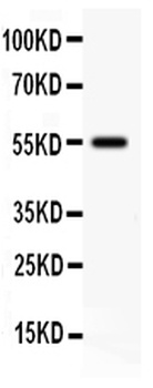 Somatostatin Receptor 2/SSTR2 Antibody