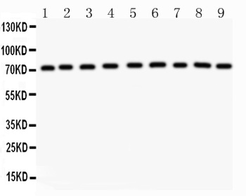 Growth hormone receptor/GHR Antibody