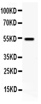 Anti-VIP Receptor 1/VIPR1 Antibody