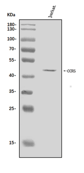 Anti-CCR5 Antibody