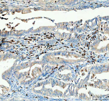 Anti-CTLA4 Antibody