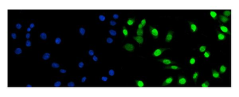 Anti-Fos B/FOSB Antibody