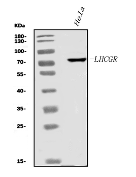 Anti-hCG receptor/LHR/LHCGR Antibody
