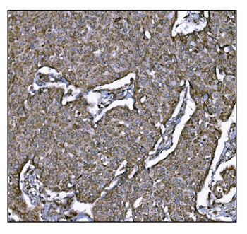 Anti-LRP1B Antibody