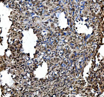 Anti-Ki67/Mki67 Antibody