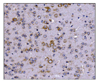 Anti-SCN1B Antibody