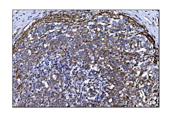 Anti-TLR8 Antibody
