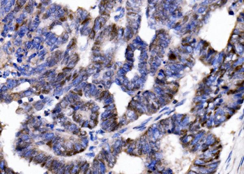 Anti-p57 Kip2/CDKN1C Antibody