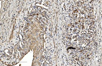 Anti-COL4A3 Antibody