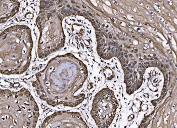 Anti-CoREST/RCOR1 Antibody