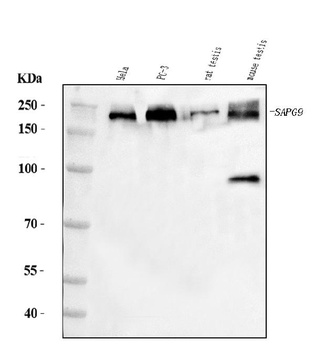 JLP/SPAG9 Antibody