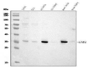 GNB1 Antibody (monoclonal, 11F9)