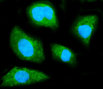 Anti-GNB1 Antibody (monoclonal, 11F9)