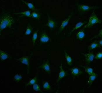 Anti-Contactin 1/CNTN1 Antibody