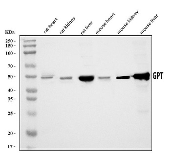 Alanine Transaminase/Gpt Antibody