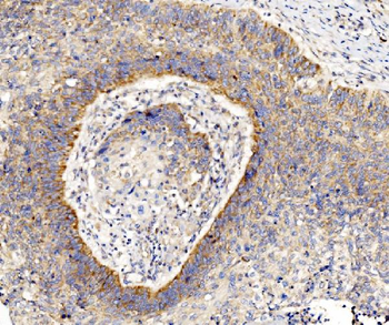 Anti-RPL8 Antibody
