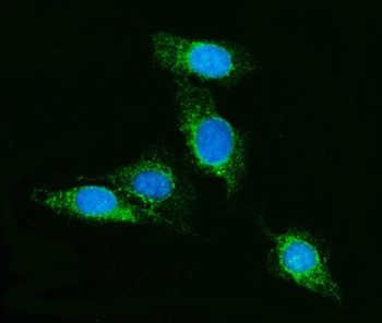 Anti-SCRN1 Antibody