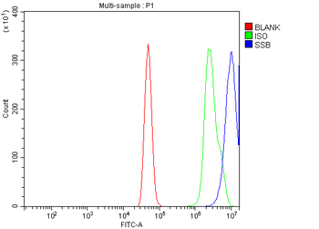 Anti-SSB Antibody