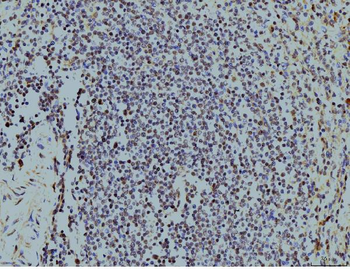 Anti-LSM8 Antibody (monoclonal, 6B11)