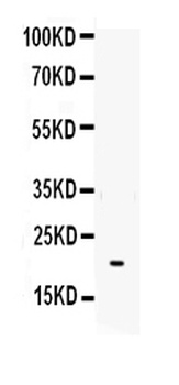 Interleukin-6 IL6 Antibody