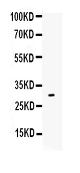 Anti-IL17/IL17A Antibody