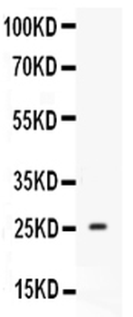 Anti-Prolactin Prl Antibody