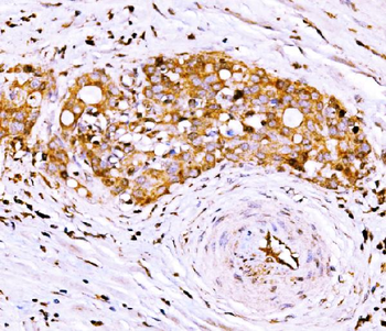 Anti-AGPAT2 Antibody