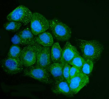 Anti-IRBIT/AHCYL1 Antibody