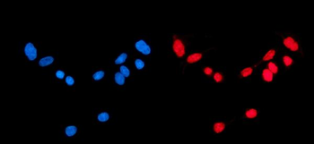 Anti-CBX1/HP1 beta Antibody