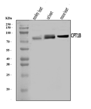 CPT1B Antibody